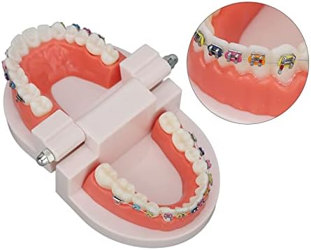 Model ortodontskih zuba, sa nosačima bukalne cijevi ortodontski tretman malokluzija studija za nastavu