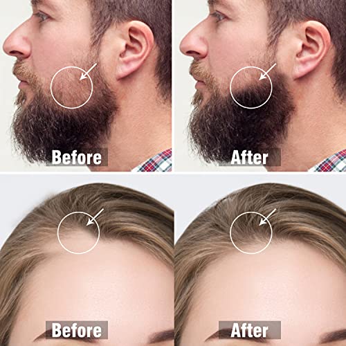 Derma Roller za rast kose i brade - 3 pakovanje istim mikroneedle valjkom za lice, brade Dermaroller za